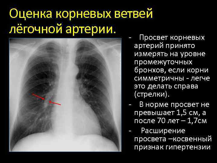 Рентгены анатомия