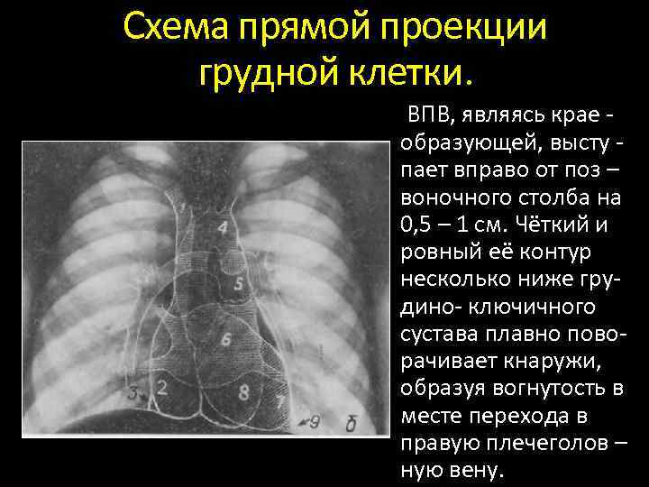 Проекции органов грудной клетки