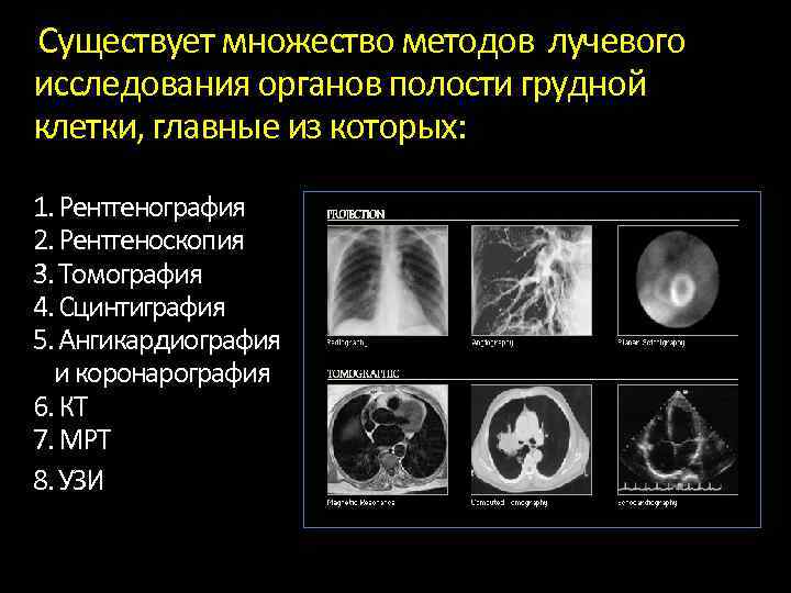 Лучевая диагностика средостения презентация