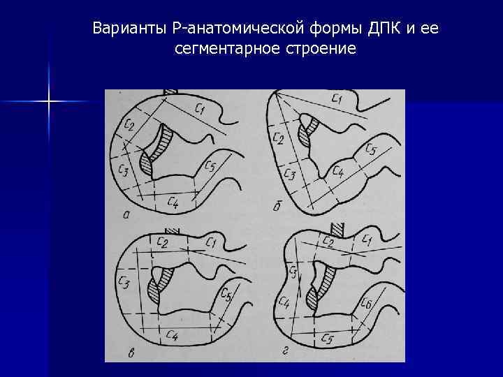 Варианты Р-анатомической формы ДПК и ее сегментарное строение 