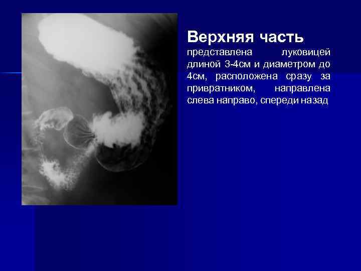 Верхняя часть представлена луковицей длиной 3 -4 см и диаметром до 4 см, расположена