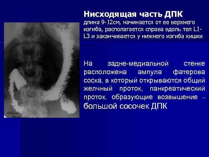 Нисходящая часть ДПК длина 9 -12 см, начинается от ее верхнего изгиба, располагается справа