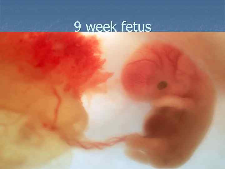 9 week fetus 