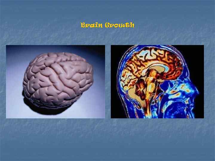 Brain Growth 