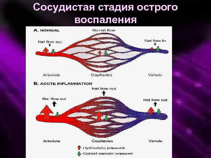 Сосудистая стадия острого воспаления 