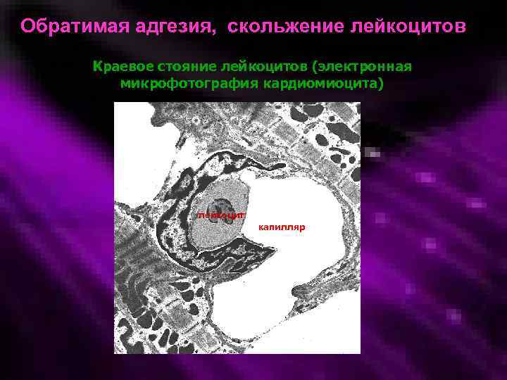 Обратимая адгезия, скольжение лейкоцитов Краевое стояние лейкоцитов (электронная микрофотография кардиомиоцита) лейкоцит капилляр 