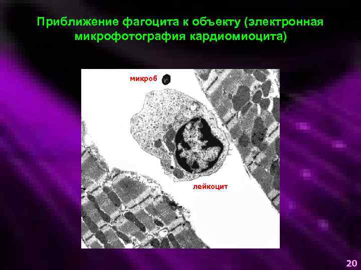 Приближение фагоцита к объекту (электронная микрофотография кардиомиоцита) микроб лейкоцит 20 