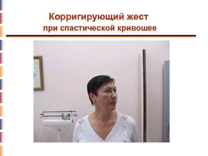 Корригирующий жест при спастической кривошее 