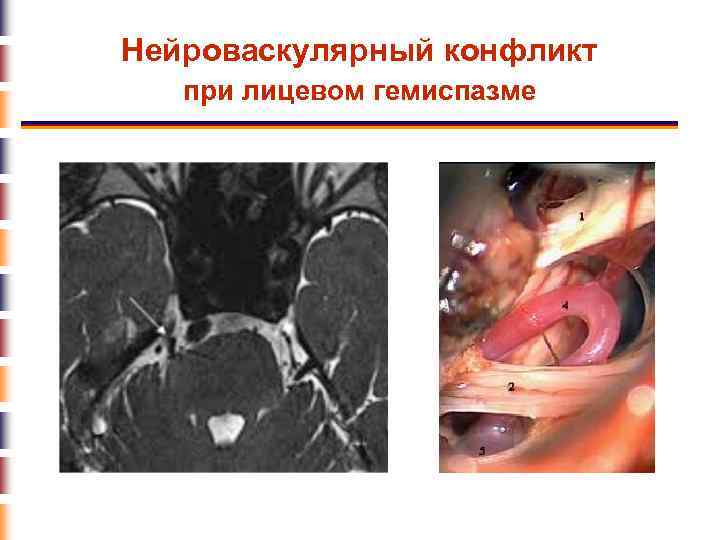 Рисунки по неврологии