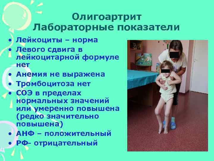 Олигоартрит Лабораторные показатели • Лейкоциты – норма • Левого сдвига в лейкоцитарной формуле нет