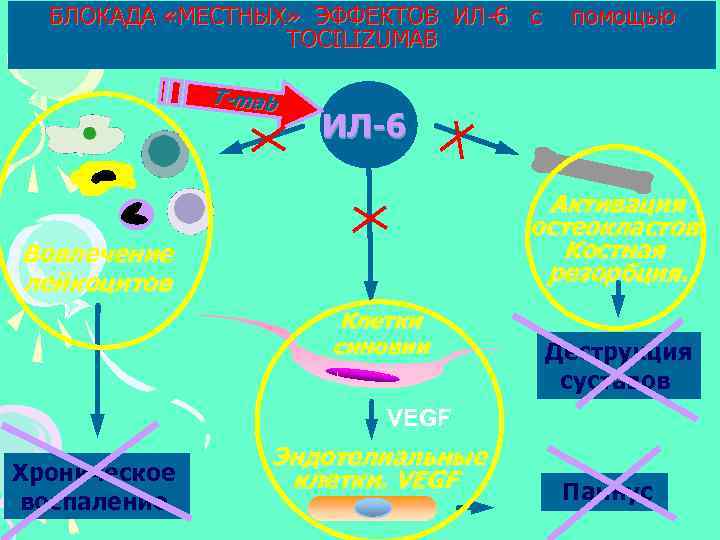 БЛОКАДА «МЕСТНЫХ» ЭФФЕКТОВ ИЛ-6 с TOCILIZUMAB T-mab помощью ИЛ-6 Aктивация остеокластов. Костная резорбция. Вовлечение