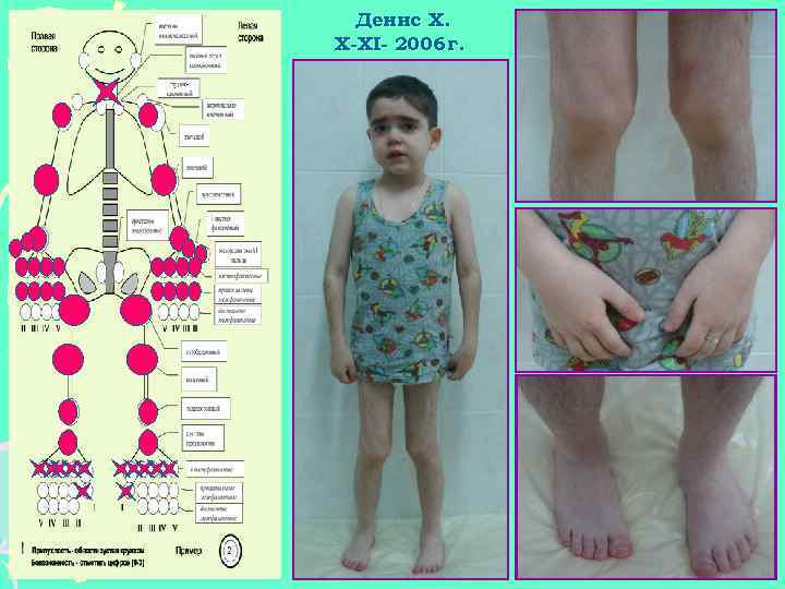 Денис Х. X-XI- 2006 г. 