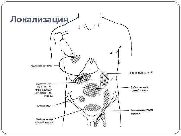 Локализация 