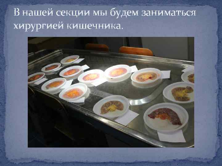 В нашей секции мы будем заниматься хирургией кишечника. 