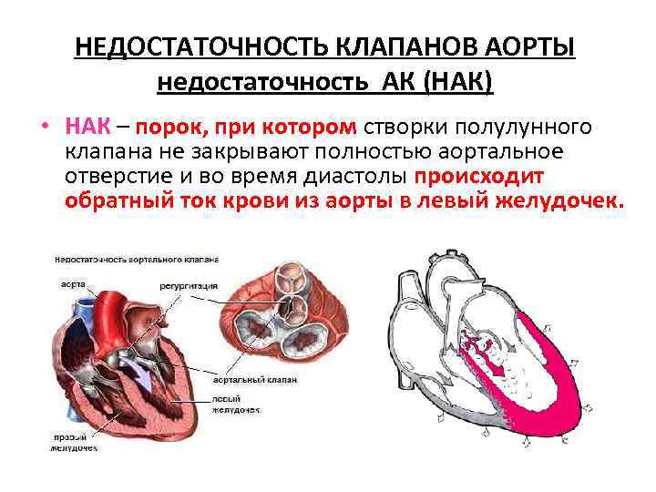 Основные клинические синдромы заболеваний сердечно сосудистой системы thumbnail