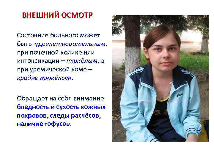 ВНЕШНИЙ ОСМОТР Состояние больного может быть удовлетворительным, при почечной колике или интоксикации – тяжёлым,