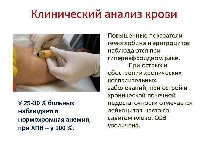 Клинический анализ крови У 25 -30 % больных наблюдается нормохромная анемия, при ХПН –