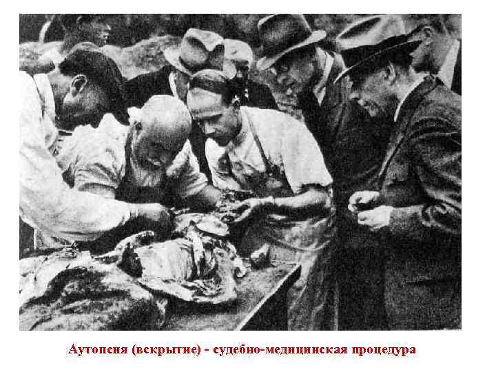 Аутопсия (вскрытие) - судебно-медицинская процедура 
