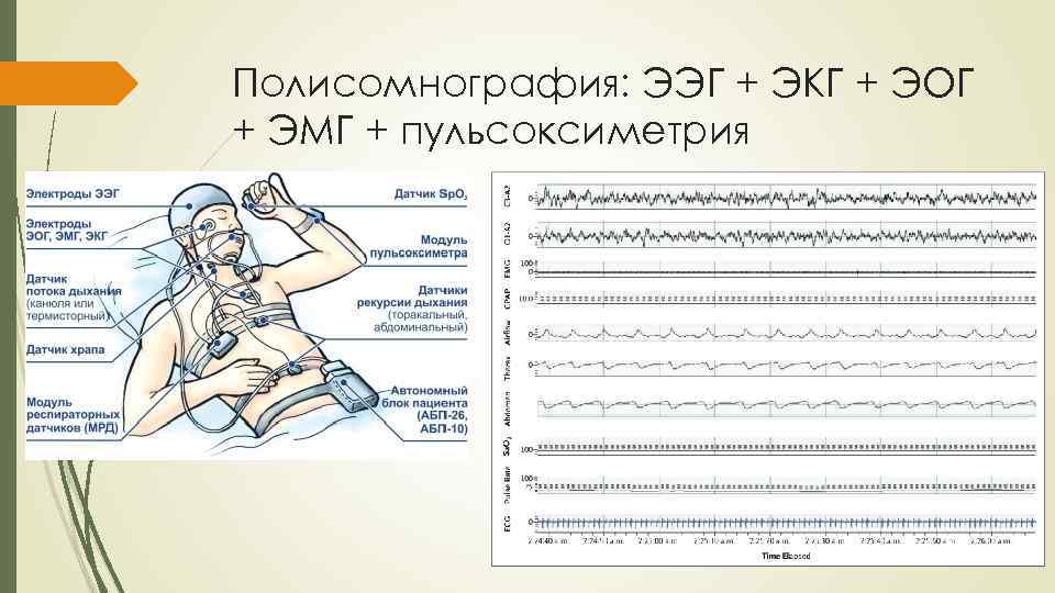 Рассмотрите рисунки изображающие электроэнцефалограммы спящего человека 206