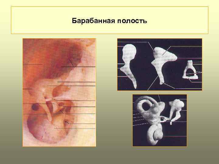 Схема барабанной полости