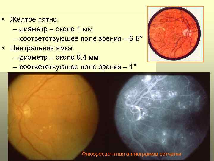 Почему желтое пятно желтое. Желтое пятно. Центральная ямка и желтое пятно. Желтое пятно функции.