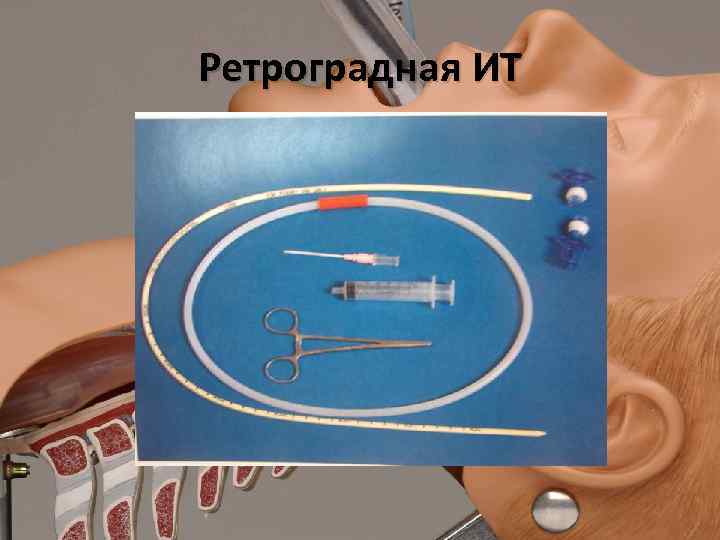 Ретроградная ИТ 