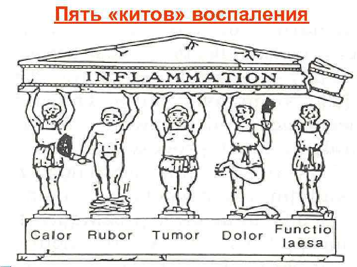 Пять «китов» воспаления 