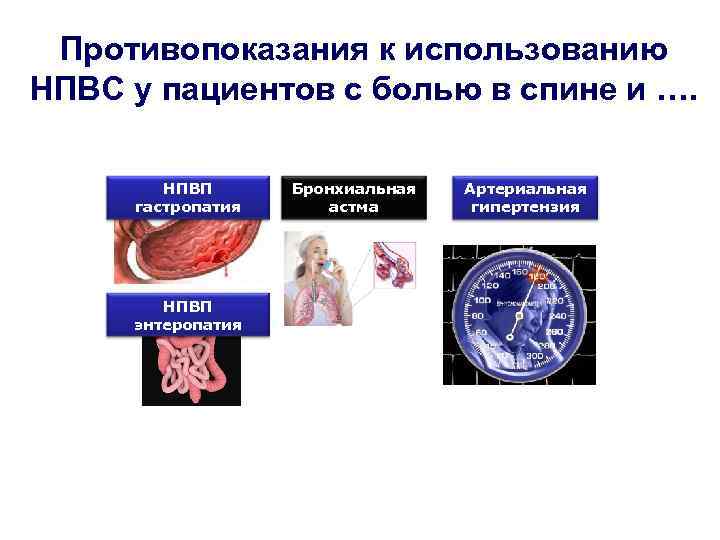 Противопоказания к использованию НПВС у пациентов с болью в спине и …. НПВП гастропатия