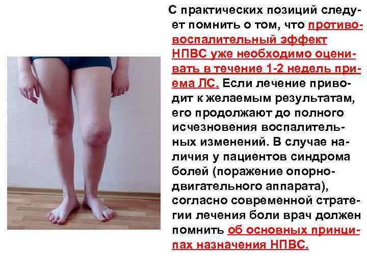  С практических позиций следует помнить о том, что противовоспалительный эффект НПВС уже необходимо