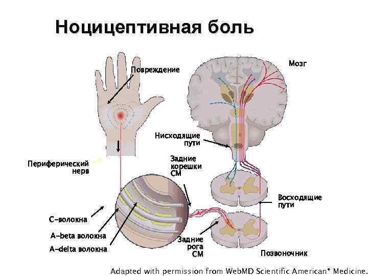 Ноцицептивная боль Повреждение Мозг Нисходящие пути Периферический нерв Задние корешки СМ Восходящие пути C-волокна