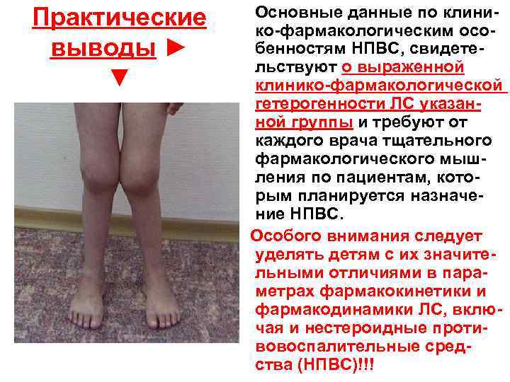 Практические выводы ► ▼ Основные данные по клинико-фармакологическим особенностям НПВС, свидетельствуют о выраженной клинико-фармакологической