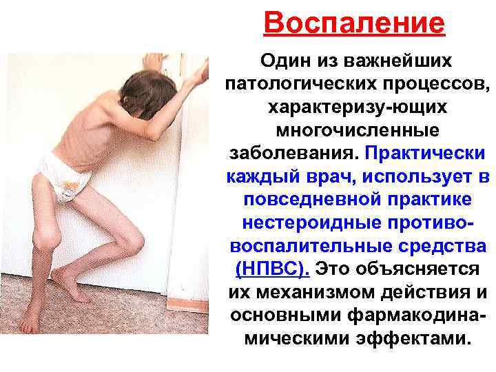 Воспаление Один из важнейших патологических процессов, характеризу-ющих многочисленные заболевания. Практически каждый врач, использует в