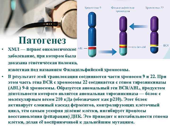 Патогенез • ХМЛ — первое онкологическое заболевание, при котором была доказана генетическая поломка, известная