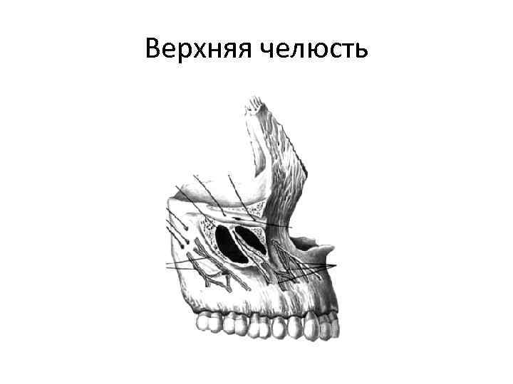 Верхняя челюсть 