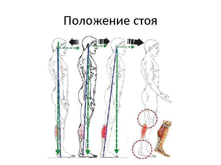Положение стоя 