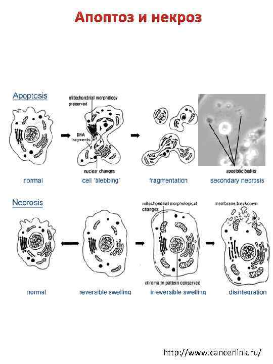 Апоптоз и некроз http: //www. cancerlink. ru/ 