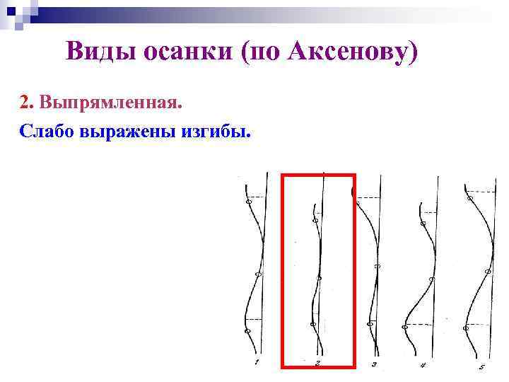 Виды осанки (по Аксенову) 2. Выпрямленная. Слабо выражены изгибы. 