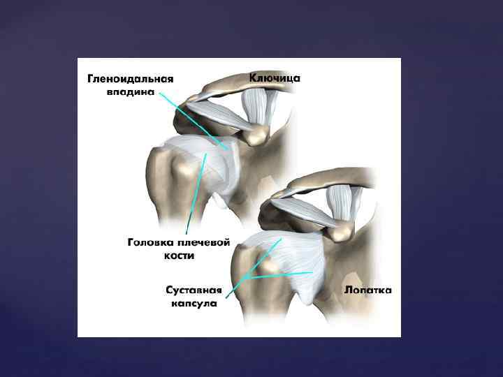 Банкарта плечевого сустава. Суставная губа плечевого сустава анатомия. Гленоидальная впадина плечевого сустава. Суставная впадина плечевой кости. Головка плечевой кости.