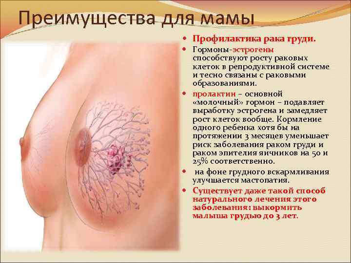 Преимущества для мамы Профилактика рака груди. Гормоны-эстрогены способствуют росту раковых клеток в репродуктивной системе
