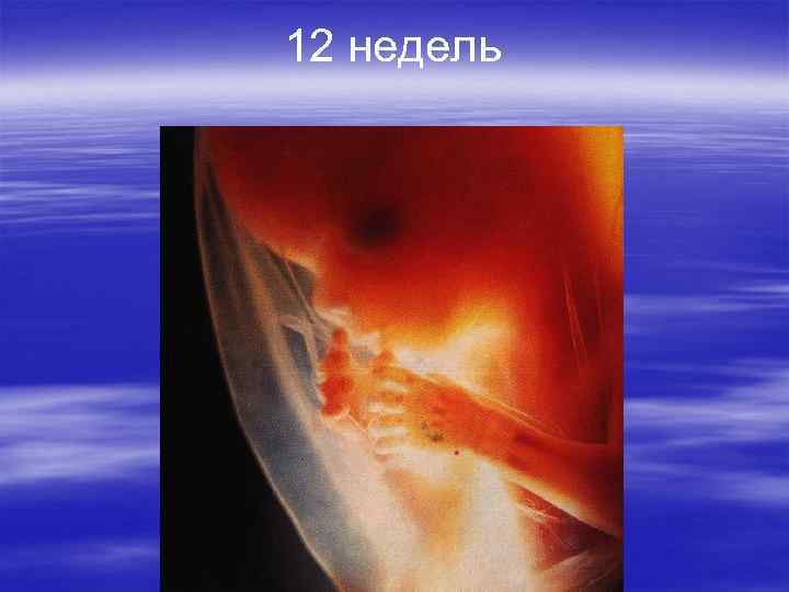 12 недель 