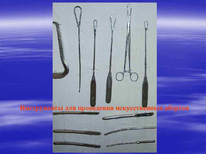 Инструменты для проведения искусственных абортов 