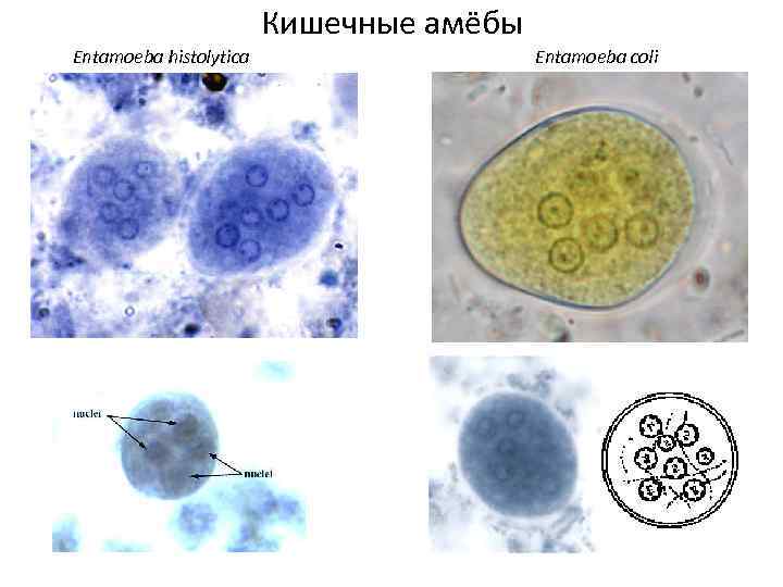 Кишечные амёбы Entamoeba histolytica Entamoeba coli 