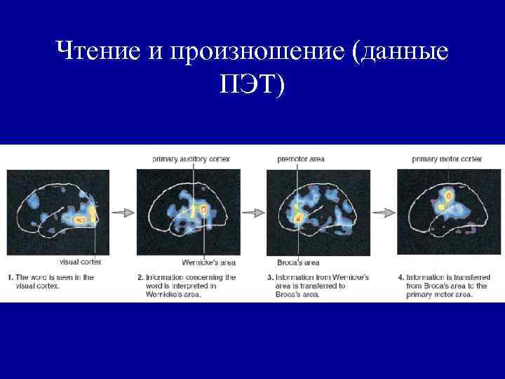 Чтение и произношение (данные ПЭТ) 