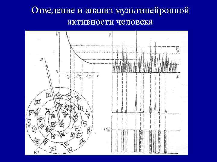 Отведение и анализ мультинейронной активности человека 