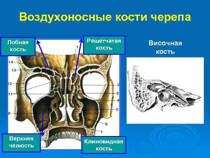 Воздухоносные кости черепа Лобная кость Верхняя челюсть Решетчатая кость Клиновидная кость Височная кость 