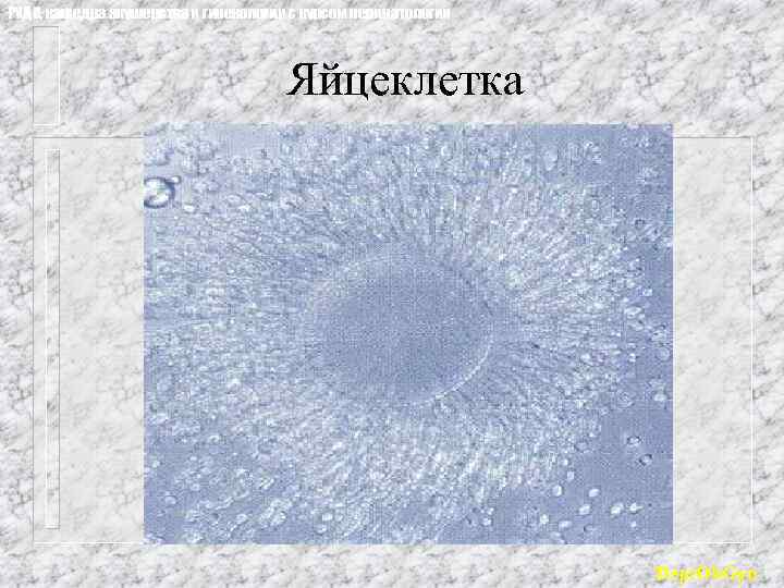 РУДН, кафедра акушерства и гинекологии с курсом перинатологии Яйцеклетка Dept. Ob. Gyn 