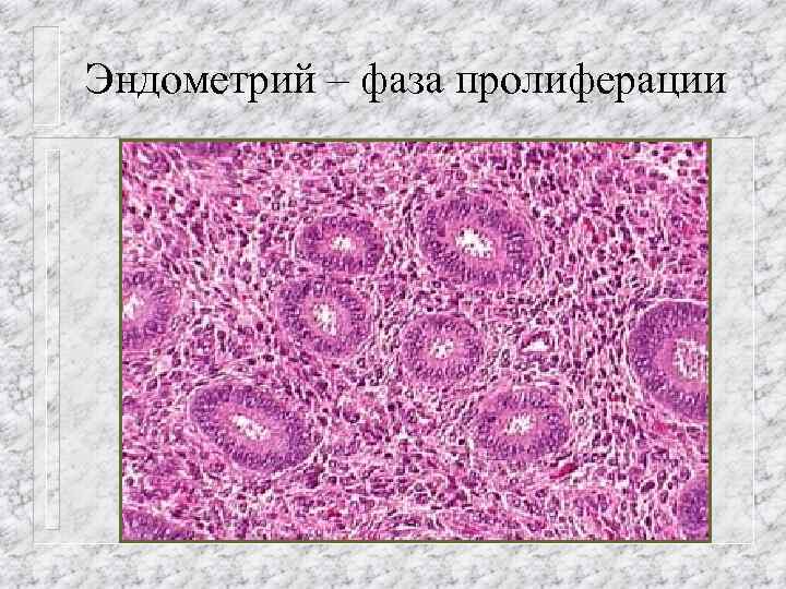 Эндометрий – фаза пролиферации 