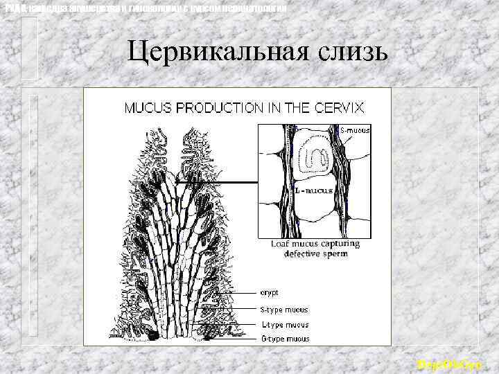 РУДН, кафедра акушерства и гинекологии с курсом перинатологии Цервикальная слизь Dept. Ob. Gyn 