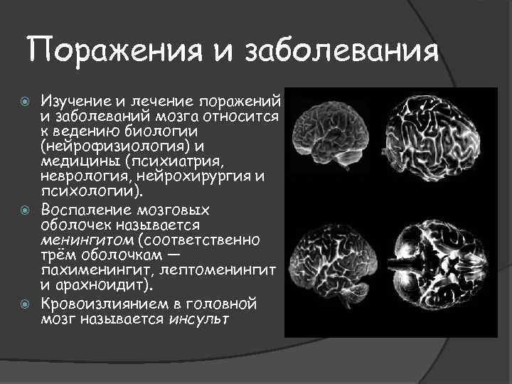 Поражения и заболевания Изучение и лечение поражений и заболеваний мозга относится к ведению биологии