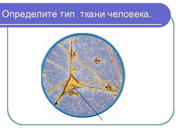 Определите тип ткани человека. 